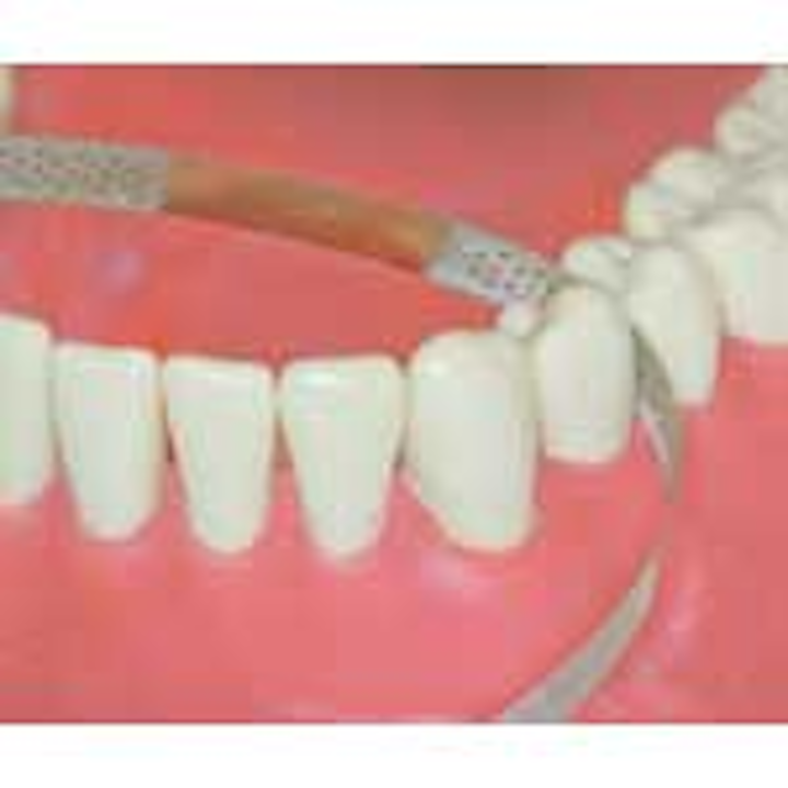 Axis perforated strips DentistryIQ