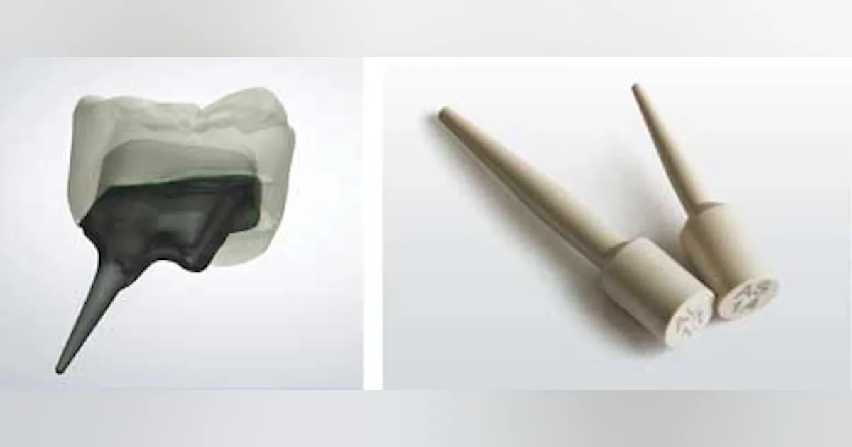 3Shape releases CAD solution for post and core restorations | Dentistry IQ