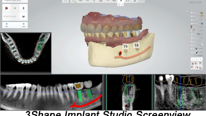 3shape Screenview