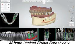3shape Screenview 3shape Screenview