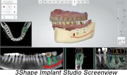 3shape Screenview 3shape Screenview