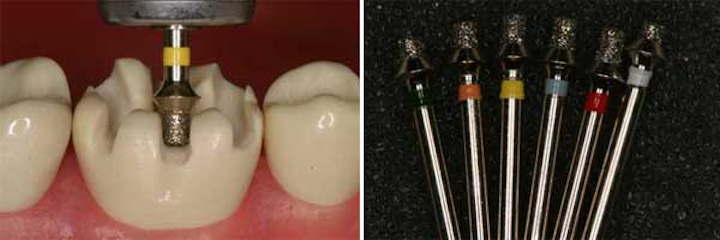 Slot prep dental