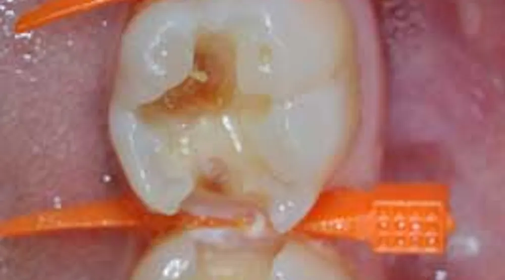 3 things a matrix system must do to be successful | Dentistry IQ