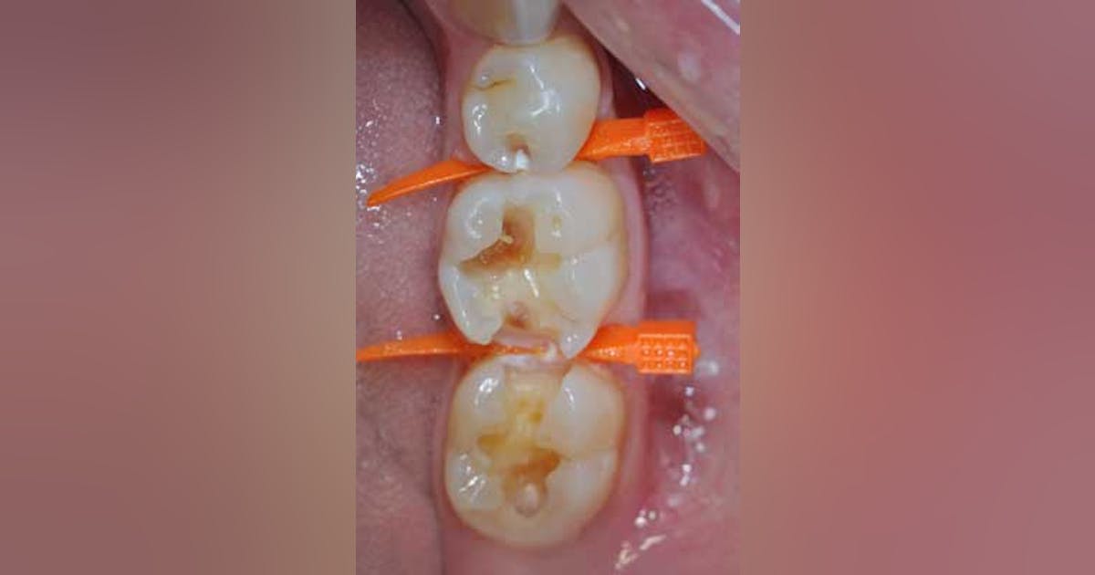 3 things a matrix system must do to be successful | Dentistry IQ