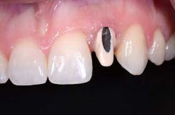 Accessopening01 Accessopening01