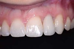 Accessopening02 Accessopening02