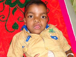 Afs Before Afs Before