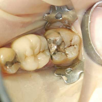 Apr112013 Gottlieb Fig1