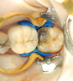 Apr112013 Gottlieb Fig3 Apr112013 Gottlieb Fig3