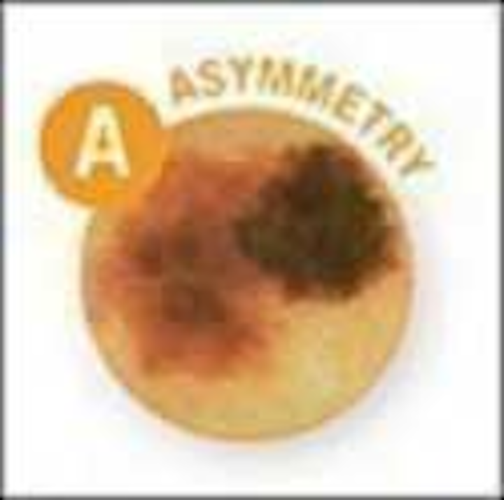 Asymmetry Fo