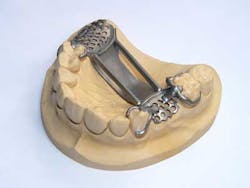 Bego Partial Bego Partial