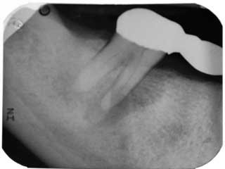 Belaniendofig1aug2013