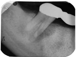 Belaniendofig1aug2013 Belaniendofig1aug2013