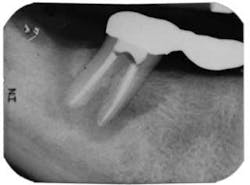 Belaniendofig2aug2013 Belaniendofig2aug2013