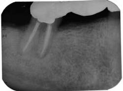 Belaniendofig3aug2013 Belaniendofig3aug2013