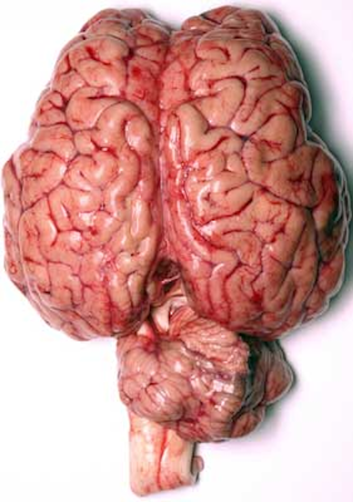 Brain Dreamstime