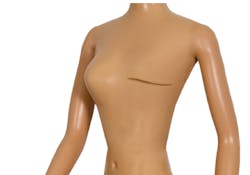 Breast Cancer Breast Cancer