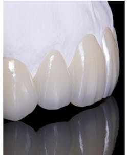 Bruxzir Anterior Crop Bruxzir Anterior Crop