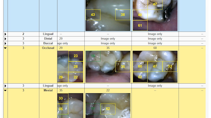 Canary Chart01