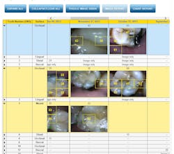 Canary Chart01 Canary Chart01