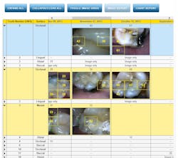 Canary Chart01 Canary Chart01