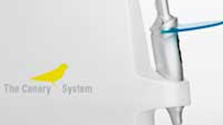 Canary System Es
