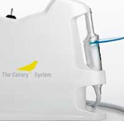 Canary System Es Canary System Es