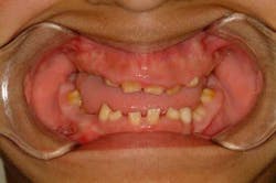 Carecredite Before Es Carecredite Before Es