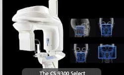 Carestream Cs9300 Carestream Cs9300