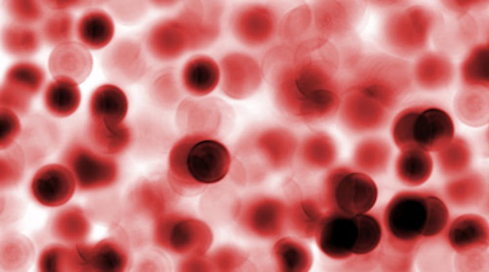 Content Dam Diq Online Articles 2015 11 Blood Cells Cancer Thumb