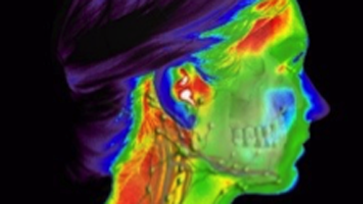 Content Dam Diq Online Articles 2015 12 Thermography 01 Thumb