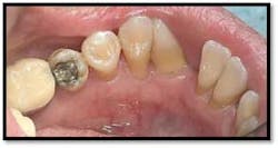 Cs1 Pretx10 Fo Cs1 Pretx10 Fo