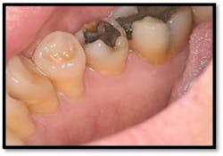 Cs1 Pretx11 Fo Cs1 Pretx11 Fo