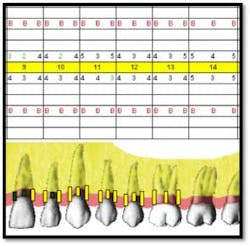 Cs1 Pretx1 Fo Cs1 Pretx1 Fo