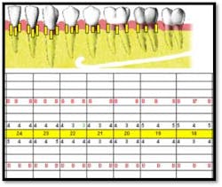 Cs1 Pretx2 Fo Cs1 Pretx2 Fo