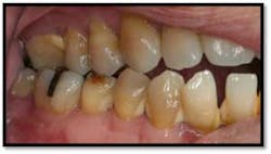 Cs1 Pretx3 Fo Cs1 Pretx3 Fo