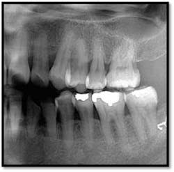 Cs1 Pretx4 Fo Cs1 Pretx4 Fo