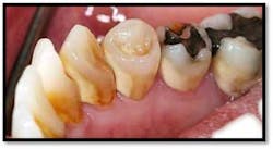 Cs1 Pretx6 Fo Cs1 Pretx6 Fo