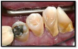 Cs1 Pretx7 Fo Cs1 Pretx7 Fo