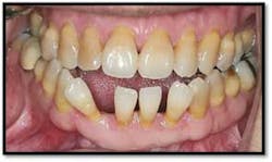 Cs1 Pretx8 Fo Cs1 Pretx8 Fo