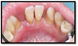 Cs1 Pretx9 Fo Cs1 Pretx9 Fo