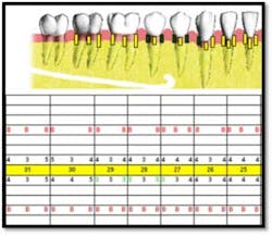Cs1 Txplan2 Fo Cs1 Txplan2 Fo