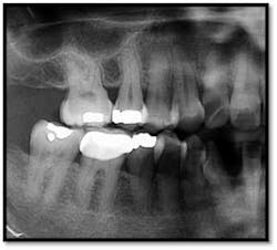Cs1 Txplan4 Fo Cs1 Txplan4 Fo