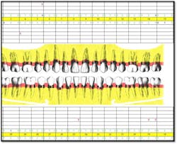 Cs2 Pocket Reduction Fo Cs2 Pocket Reduction Fo