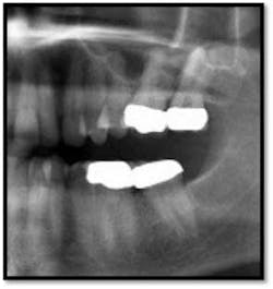 Cs2 Pretx8 Fo Cs2 Pretx8 Fo