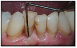 Cs3 13month3 Fo Cs3 13month3 Fo