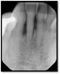 Cs3 13month4 Fo Cs3 13month4 Fo