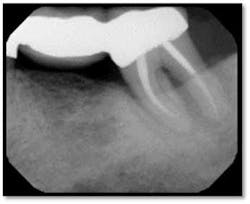 Cs3 13month6 Fo Cs3 13month6 Fo