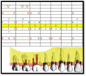 Case study use of perioscopy and LANAP for treatment of advanced