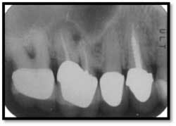 Cs3 Pretx2 Fo Cs3 Pretx2 Fo